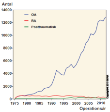 se Ledprotesinfektioner Primär knäprotes i Sverige Uni-protes Total-protes Från