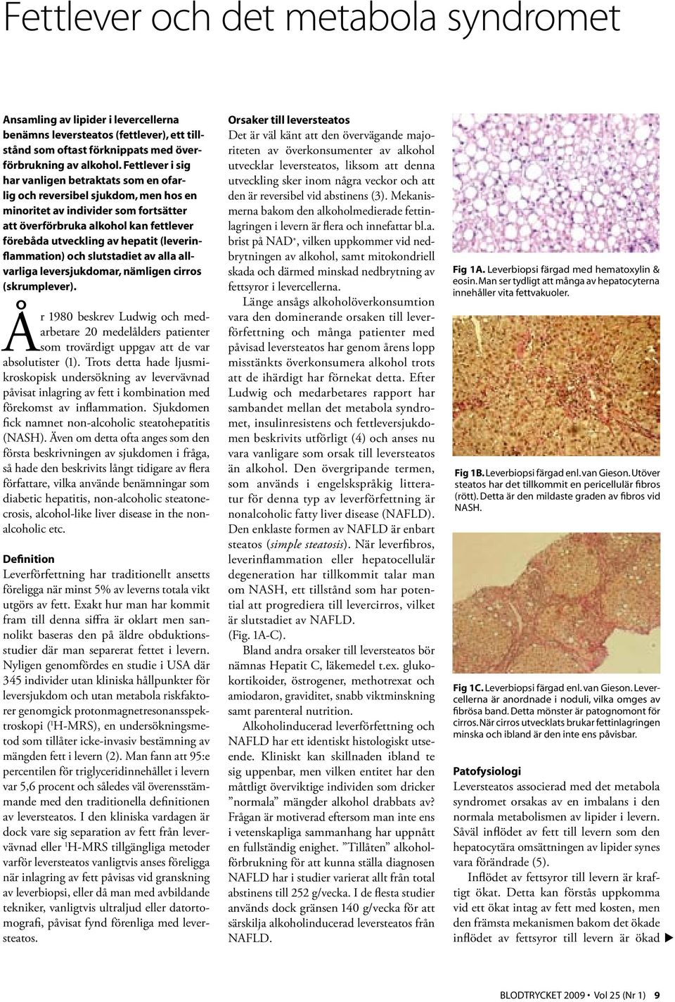 (leverinflammation) och slutstadiet av alla allvarliga leversjukdomar, nämligen cirros (skrumplever).