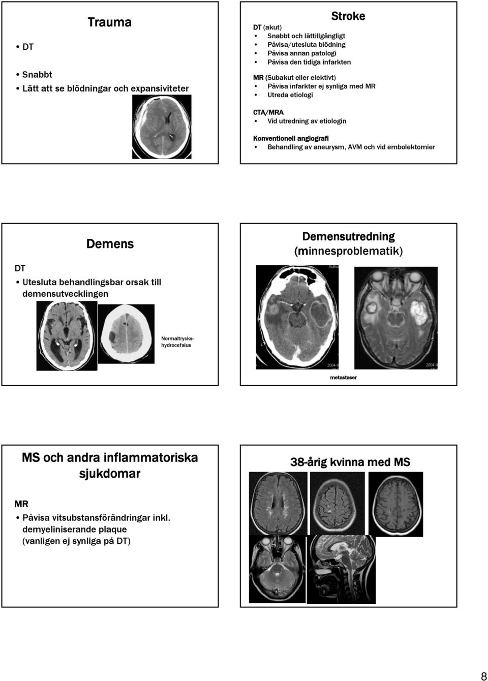 Behandling av aneurysm, AVM och vid embolektomier Demens DT Utesluta behandlingsbar orsak till demensutvecklingen Demensutredning (minnesproblematik)