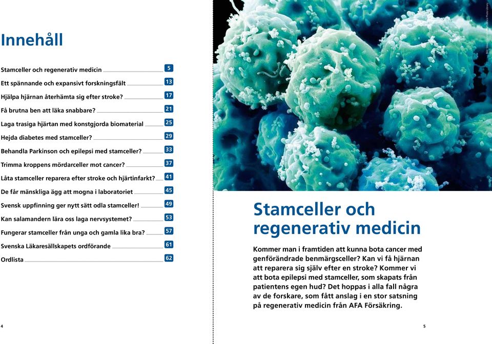 Trimma kroppens mördar celler mot cancer? Låta stamceller reparera efter stroke och hjärtinfarkt? De får mänskliga ägg att mogna i laboratoriet Svensk uppfinning ger nytt sätt odla stamceller!