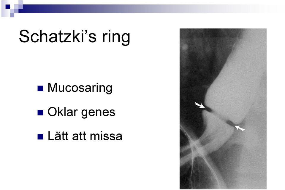 Mucosa Oklar