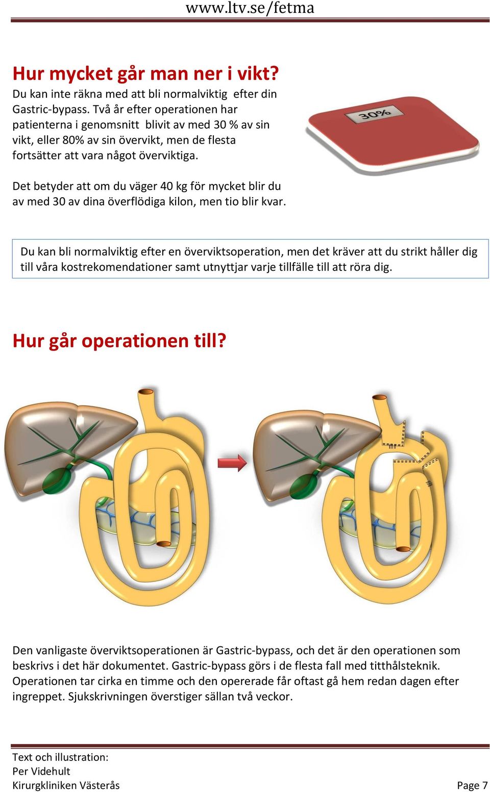 Det betyder att om du väger 40 kg för mycket blir du av med 30 av dina överflödiga kilon, men tio blir kvar.