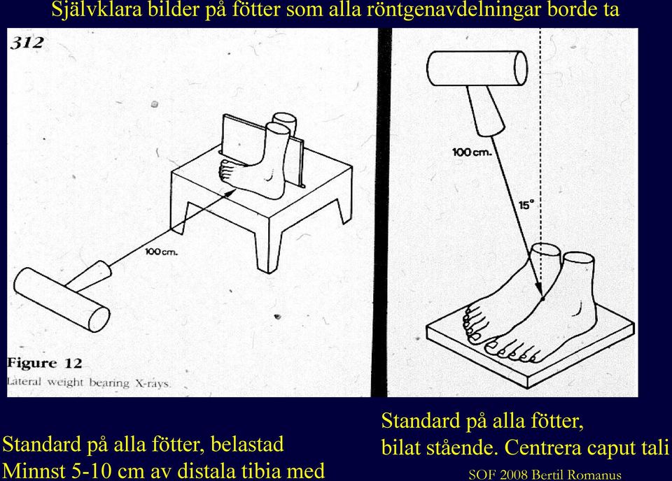 belastad Minnst 5-10 cm av distala tibia med Standard