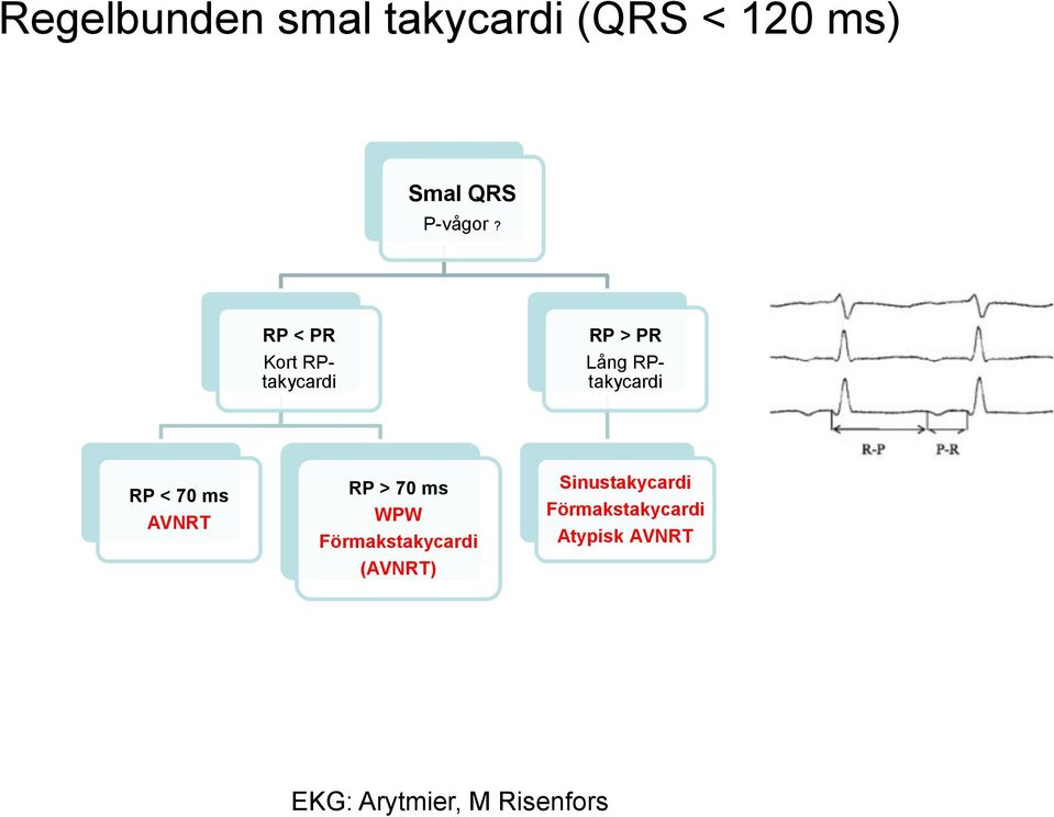 RP < PR Kort RPtakycardi RP > PR Lång RPtakycardi RP