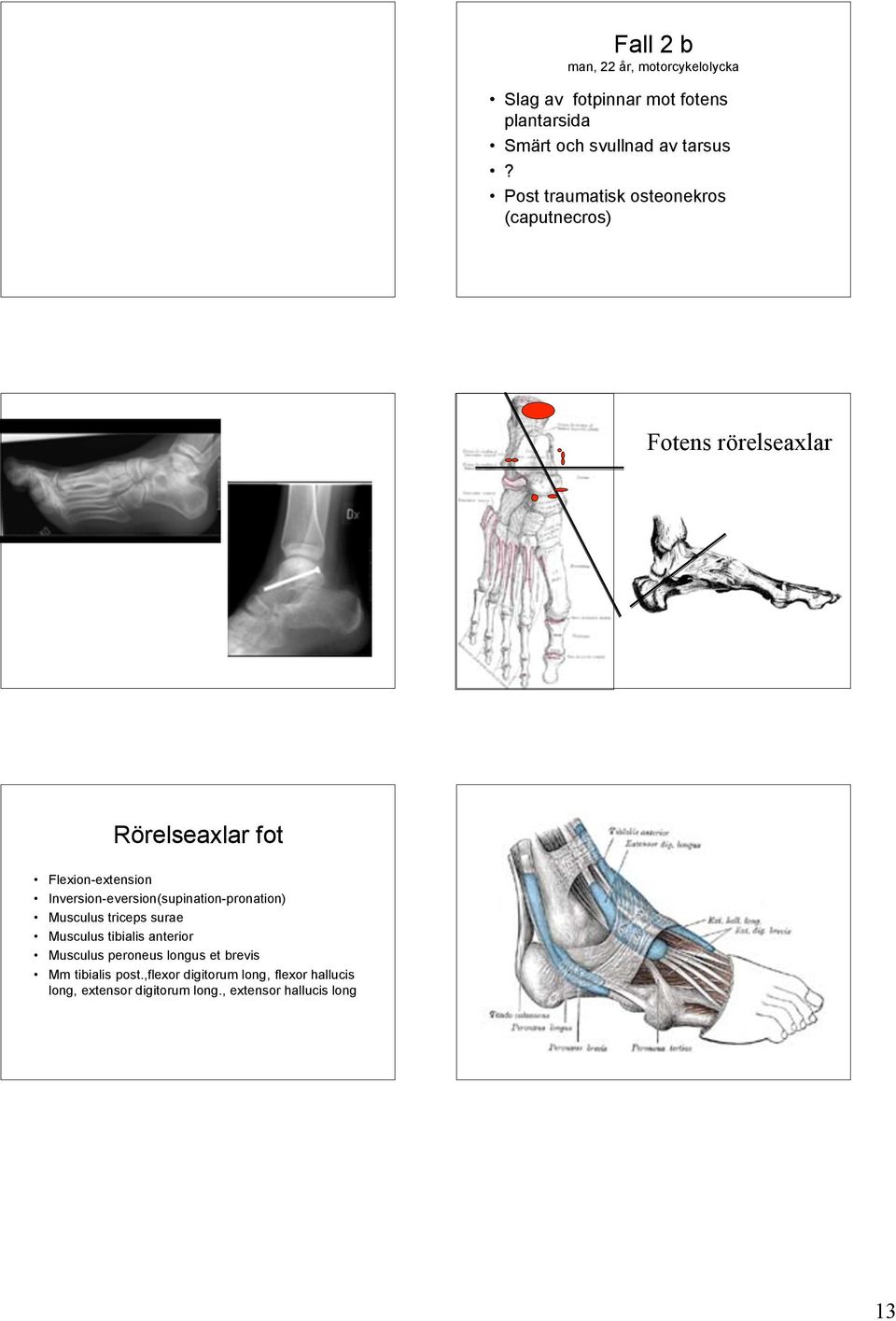 Inversion-eversion(supination-pronation) Musculus triceps surae Musculus tibialis anterior Musculus peroneus