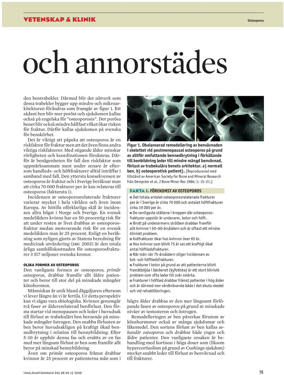 Därför kallas sjukdomen på svenska för benskörhet. Det är viktigt att påpeka att osteoporos är en riskfaktor för fraktur men att det även finns andra viktiga riskfaktorer.