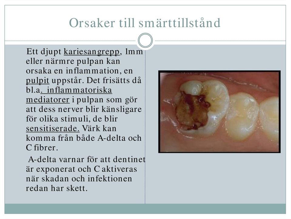 mation, en pulpit uppstår. Det frisätts då bl.a. matoriska mediatorer i pulpan som gör att dess nerver