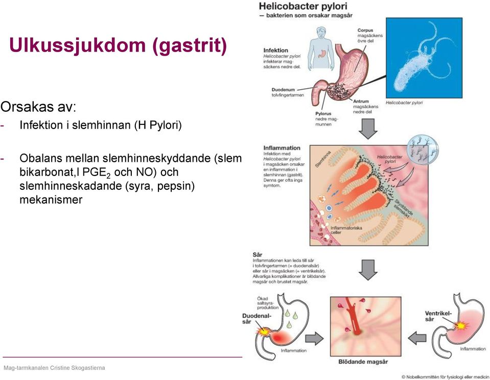 bikarbonat,l PGE 2 och NO) och slemhinneskadande (syra,