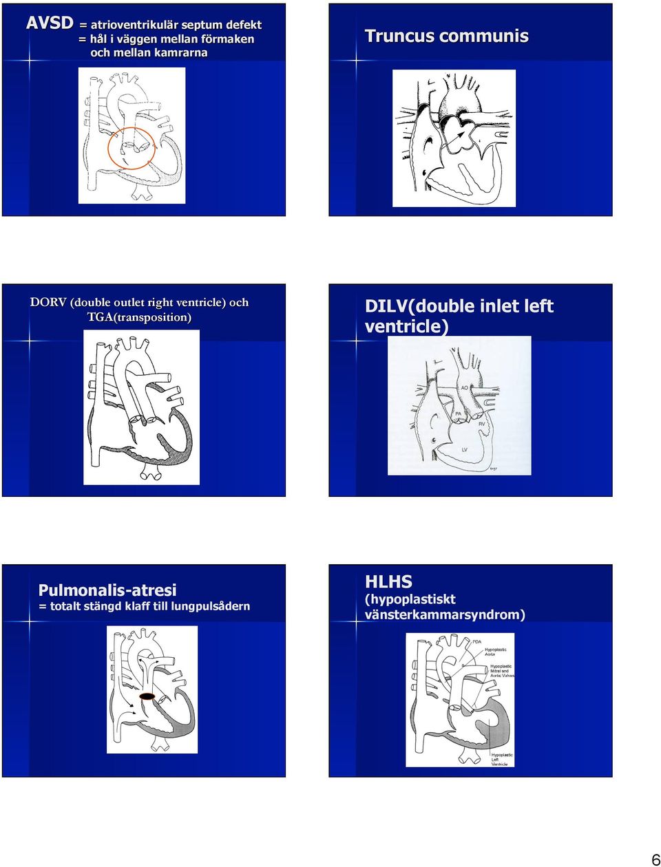 TGA(transposition) DILV(double inlet left ventricle) Pulmonalis-atresi =