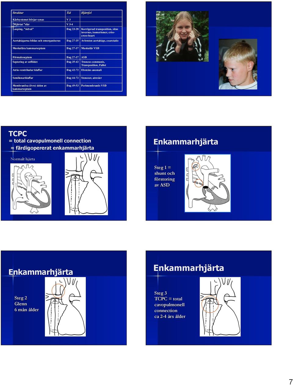 klaffar Dag 42-72 Ebsteins anomali Semilunarklaffar Dag 44-72 Stenoser, atresier Membranösa (övre) delen av kammarseptum Dag 49-53 Perimembranös VSD TCPC Hjärtfel = total cavopulmonell connection =
