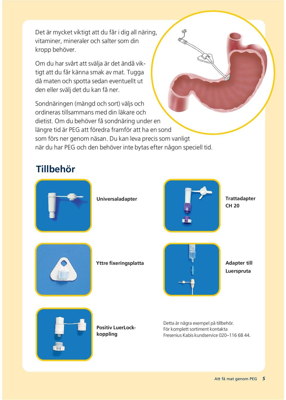 Om du behöver få sondnäring under en längre tid är PEG att föredra framför att ha en sond som förs ner genom näsan.