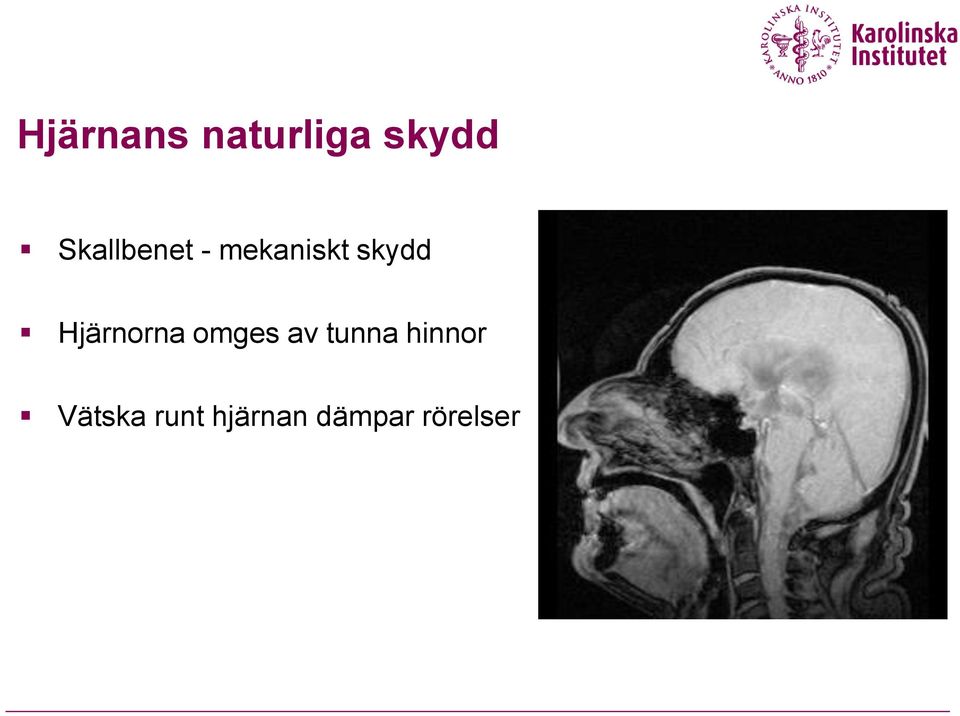 Hjärnorna omges av tunna
