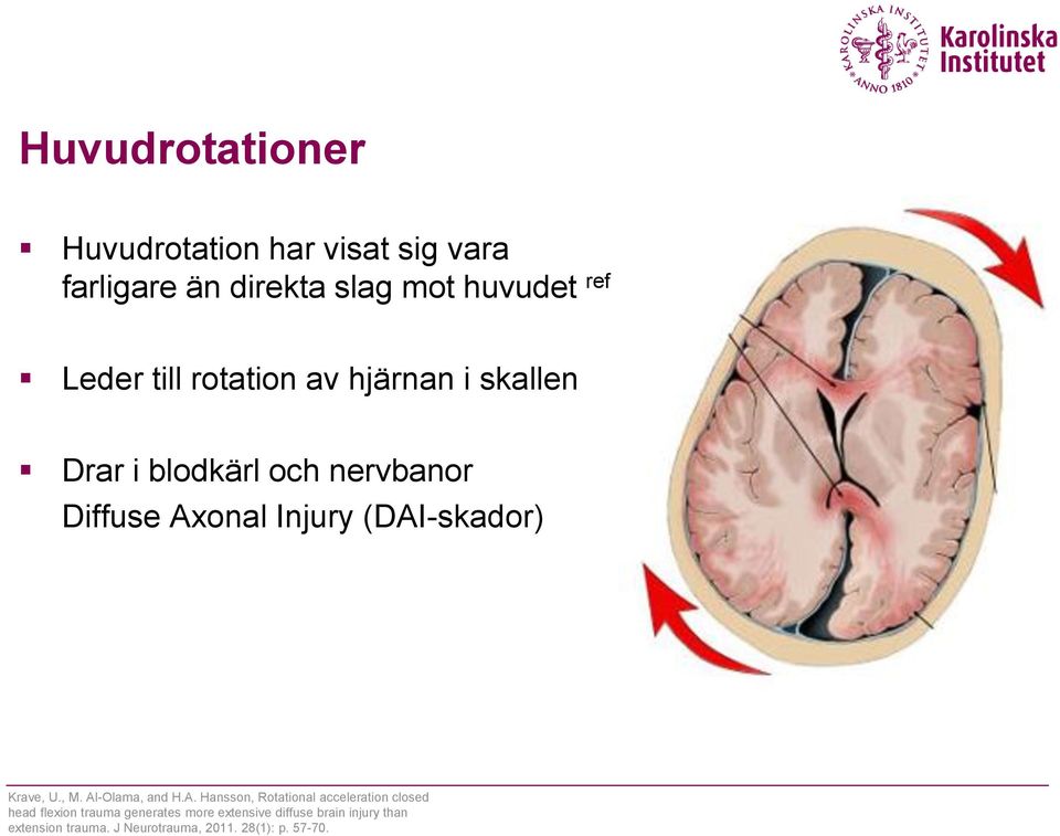 (DAI-skador) Krave, U., M. Al-Olama, and H.A. Hansson, Rotational acceleration closed head flexion
