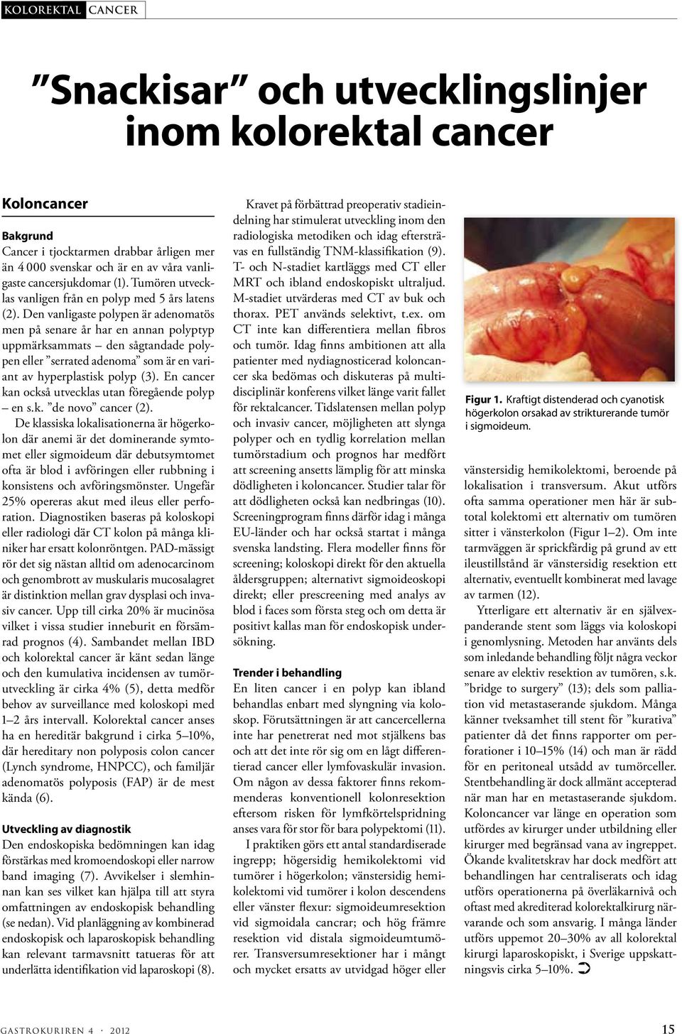 Den vanligaste polypen är adenomatös men på senare år har en annan polyptyp uppmärksammats den sågtandade polypen eller serrated adenoma som är en variant av hyperplastisk polyp (3).