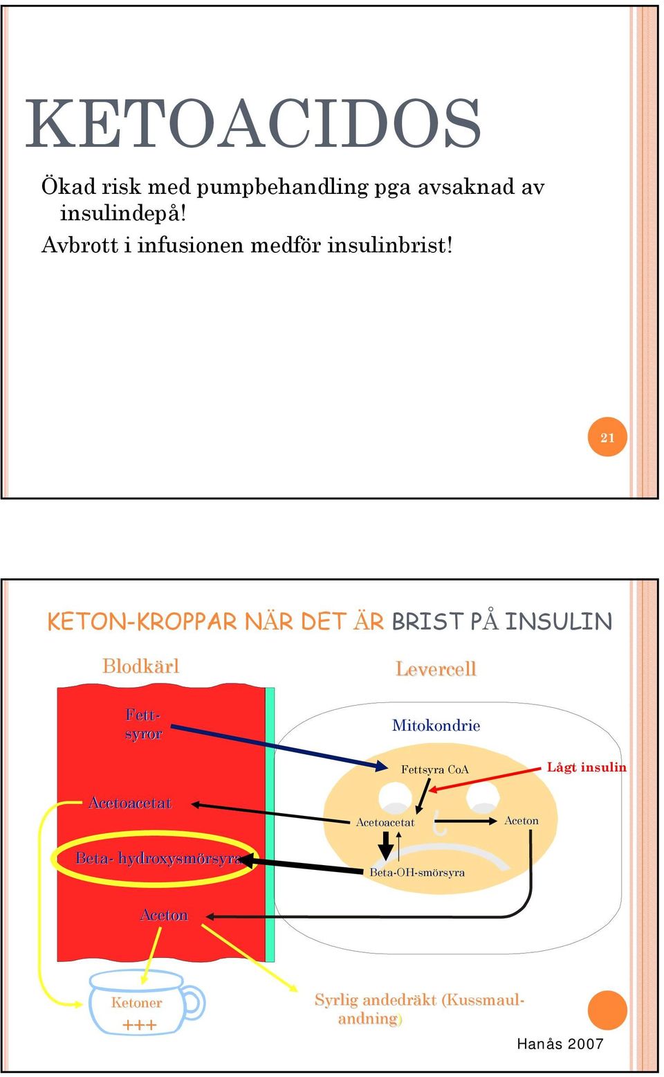 21 KETON-KROPPAR NÄR DET ÄR BRIST PÅ INSULIN Blodkärl Levercell Mitokondrie Fettsyra CoA Lågt