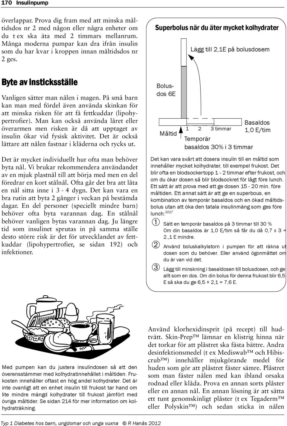 Superbolus när du äter mycket kolhydrater Lägg till 2,1E på bolusdosem Byte av insticksställe Vanligen sätter man nålen i magen.