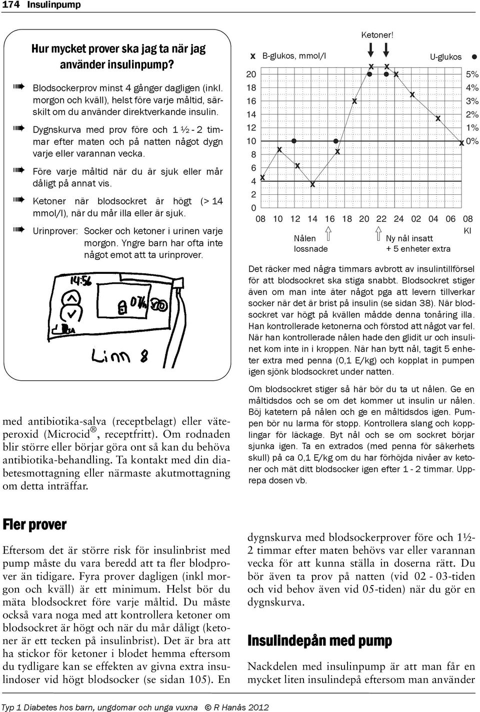 Före varje måltid när du är sjuk eller mår dåligt på annat vis. Ketoner när blodsockret är högt (> 14 mmol/l), när du mår illa eller är sjuk. Urinprover: Socker och ketoner i urinen varje morgon.