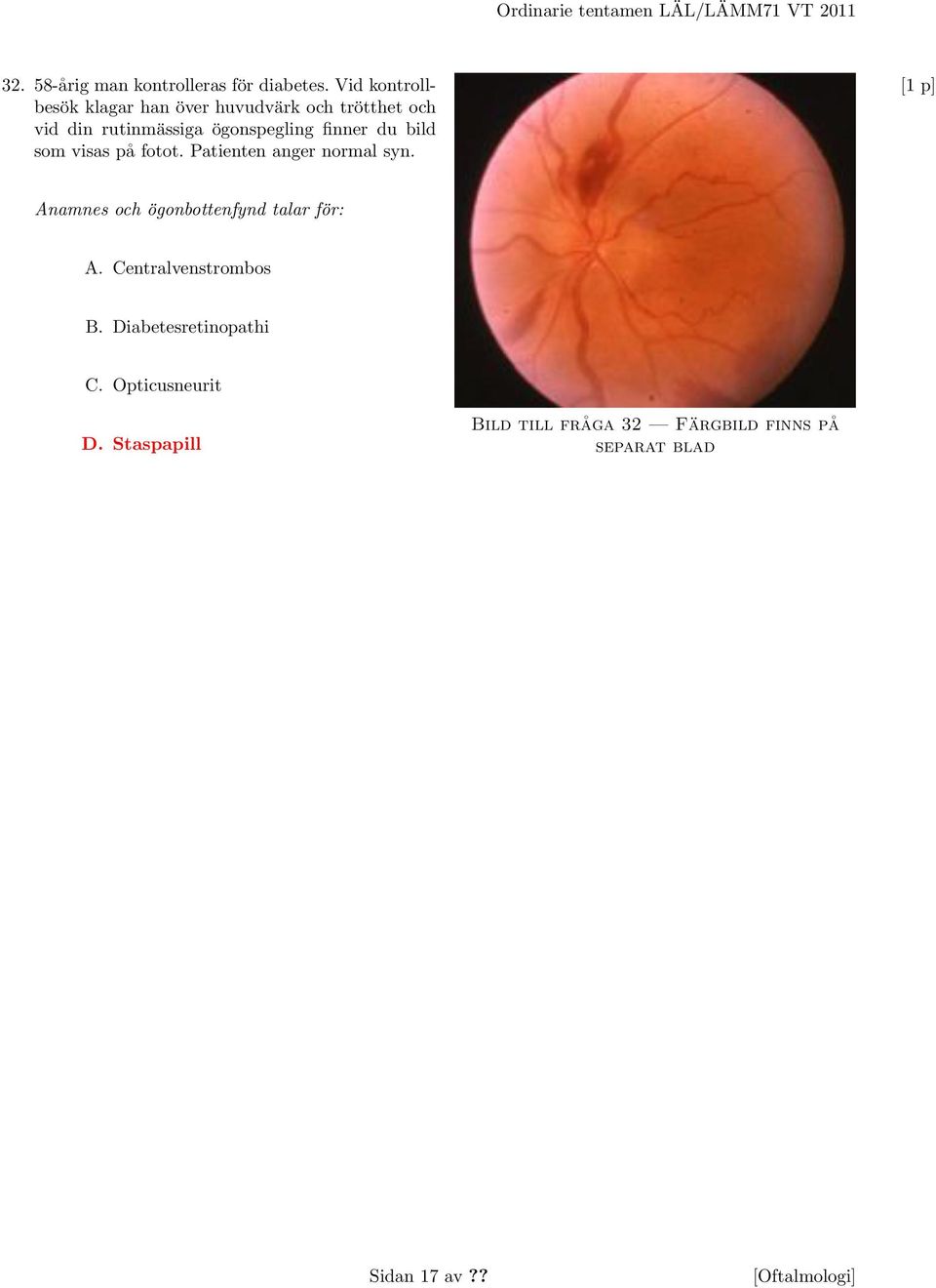 bild som visas på fotot. Patienten anger normal syn. Anamnes och ögonbottenfynd talar för: A.