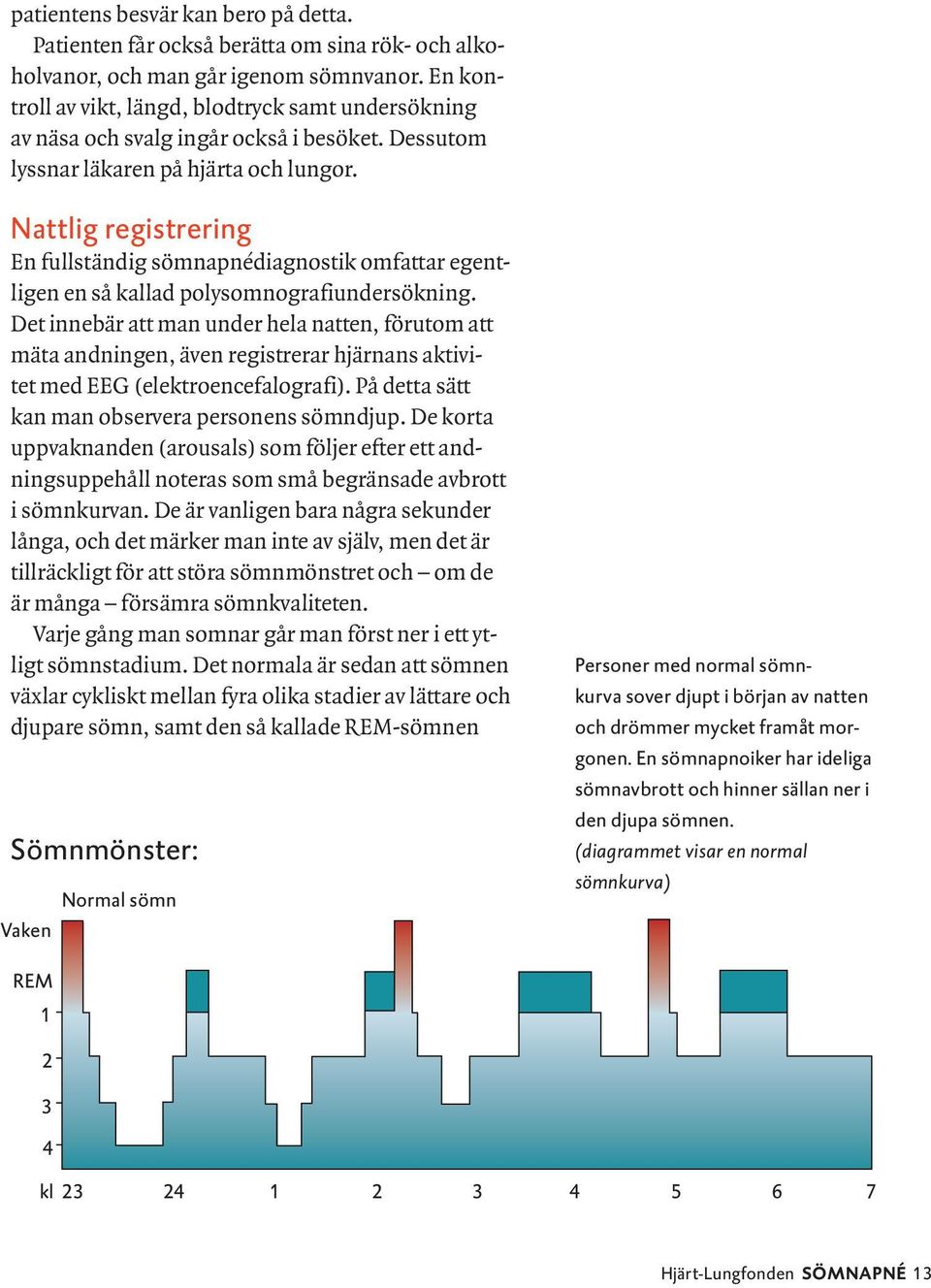 Nattlig registrering En fullständig sömnapnédiagnostik omfattar egentligen en så kallad polysomnografiundersökning.