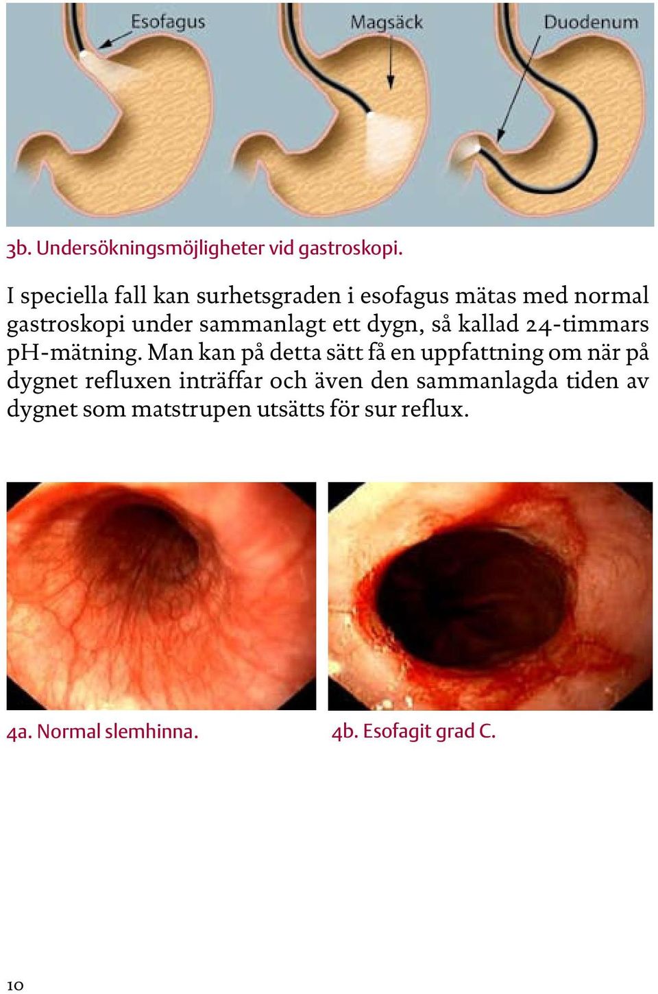 ett dygn, så kallad 4-timmars ph-mätning.