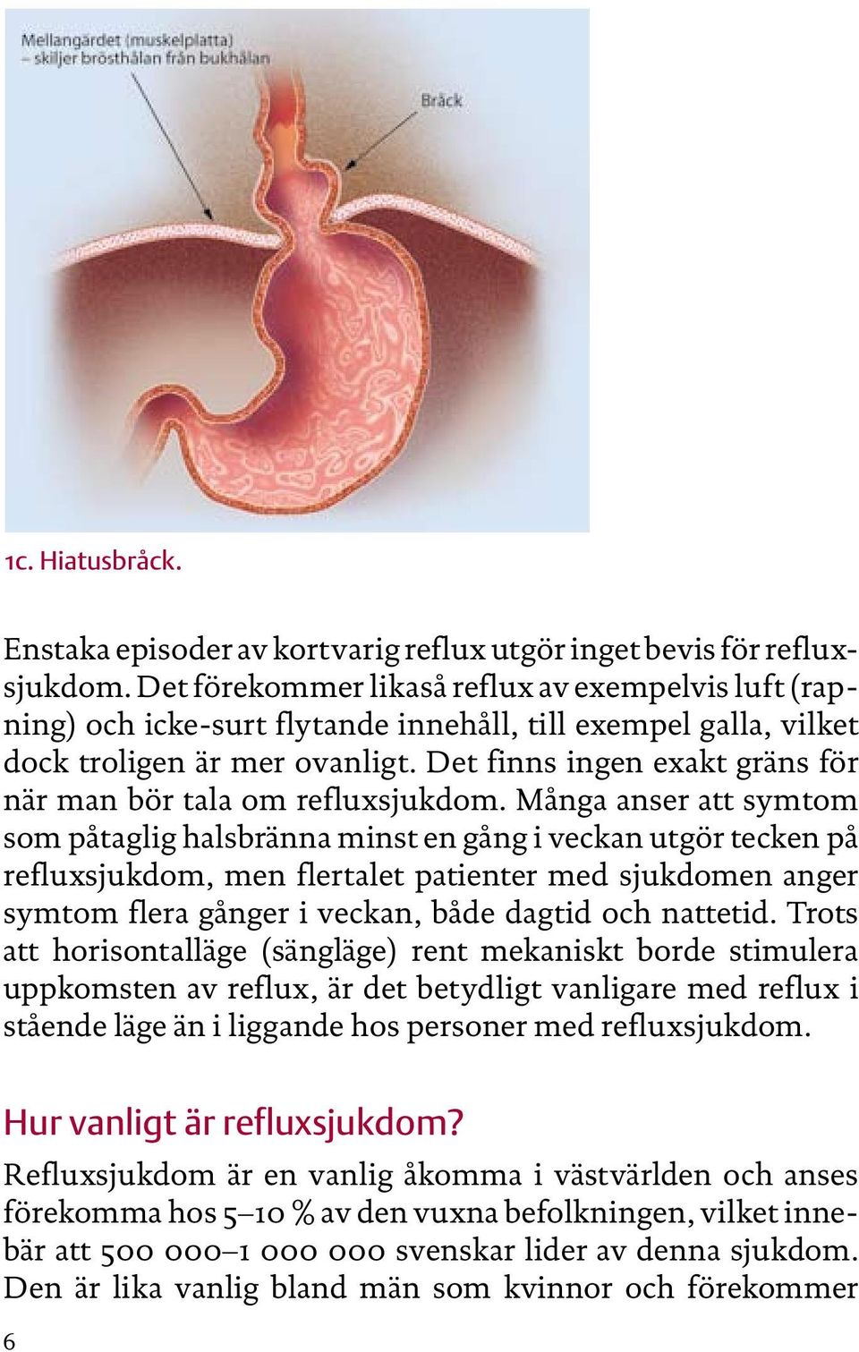 Det finns ingen exakt gräns för när man bör tala om refluxsjukdom.