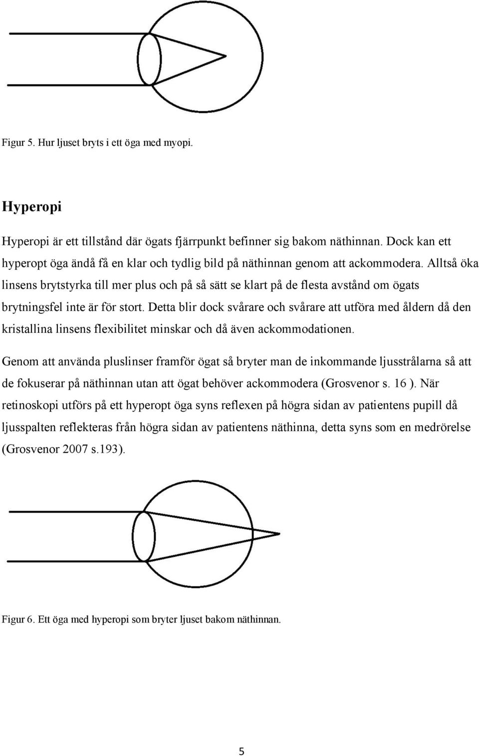 Alltså öka linsens brytstyrka till mer plus och på så sätt se klart på de flesta avstånd om ögats brytningsfel inte är för stort.