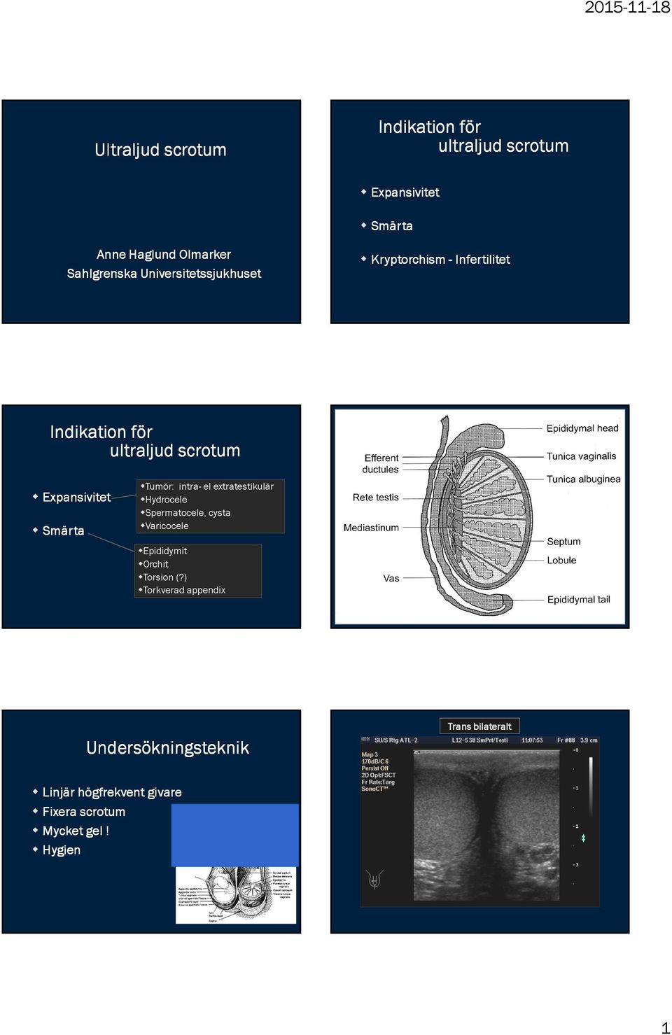 Tumör: intra- el extratestikulär Hydrocele Spermatocele, cysta Varicocele Epididymit Orchit Torsion (?