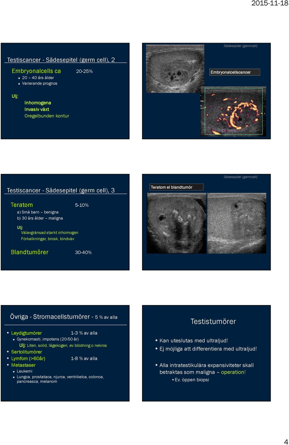 brosk, bindväv Blandtumörer 30-40% Övriga - Stromacellstumörer - 5 % av alla Leydigtumörer 1-3 % av alla Gynekomasti, impotens (20-50 år) Ulj: Liten, solid, lågekogen, ev blödning o nekros