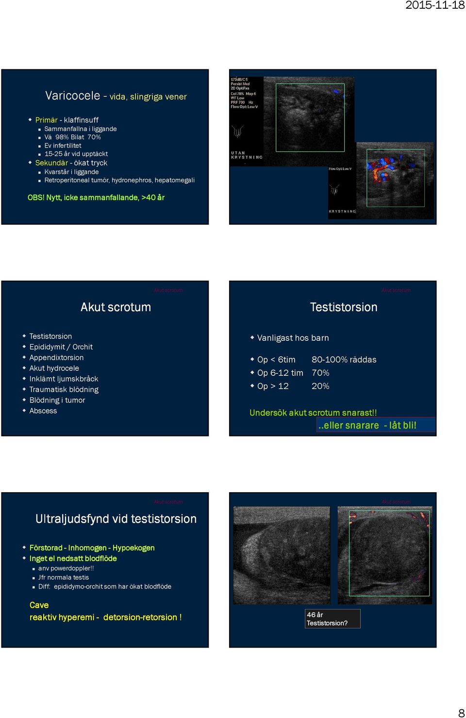 Nytt, icke sammanfallande,, >40 år Testistorsion Testistorsion Epididymit / Orchit Appendixtorsion Akut hydrocele Inklämt ljumskbråck Traumatisk blödning Blödning i tumor Abscess Vanligast hos barn