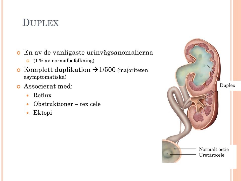 (majoriteten asymptomatiska) Associerat med: Reflux