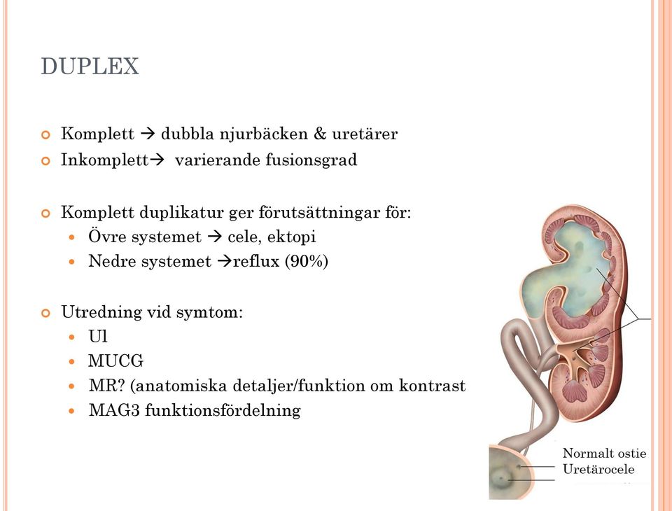 systemet cele, ektopi Nedre systemet reflux (90%) Utredning vid