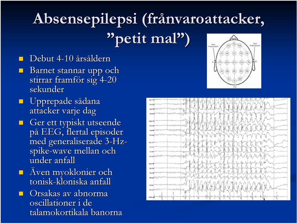 episoder med generaliserade 3-Hz3 Hz- spike-wave mellan och under anfall Även myoklonier och