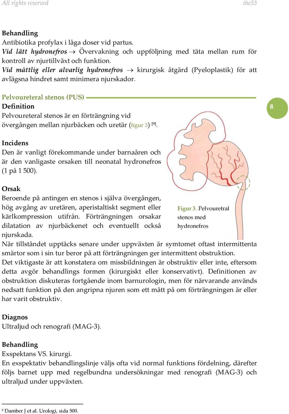 Pelvoureteral stenos (PUS) Pelvoureteral stenos är en förträngning vid övergången mellan njurbäcken och uretär (figur 3) [9].