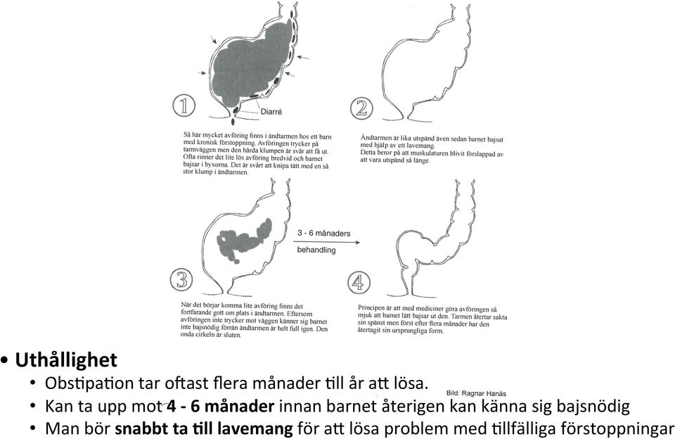 Kan ta upp mot 4-6 månader innan barnet återigen kan