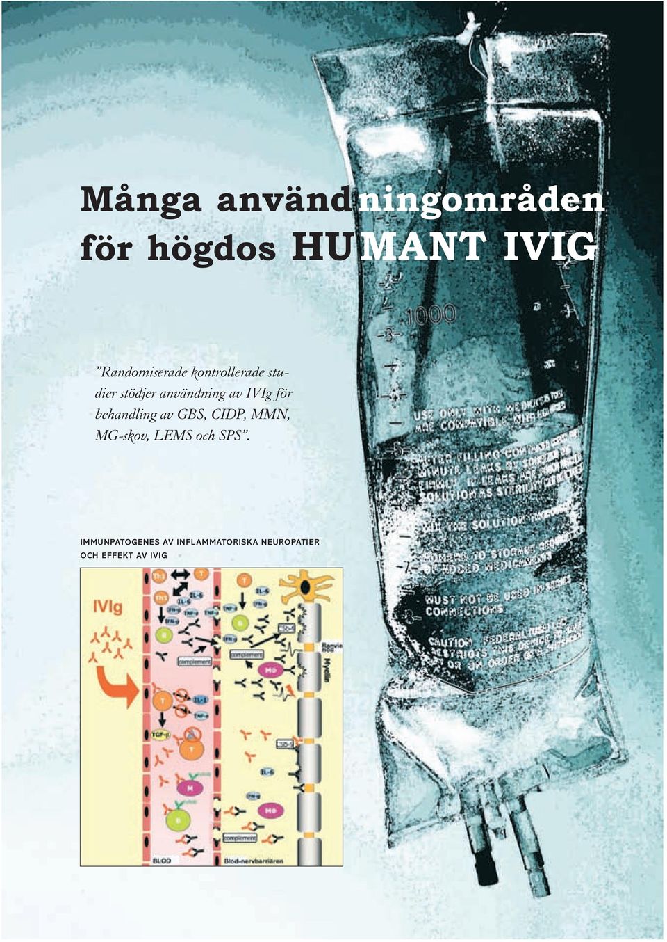 av GBS, CIDP, MMN, MG-skov, LEMS och SPS.
