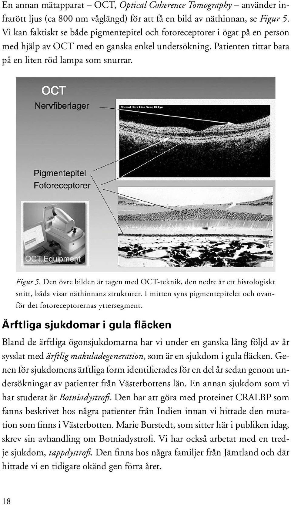 Den övre bilden är tagen med OCT-teknik, den nedre är ett histologiskt snitt, båda visar näthinnans strukturer. I mitten syns pigmentepitelet och ovanför det fotoreceptorernas yttersegment.