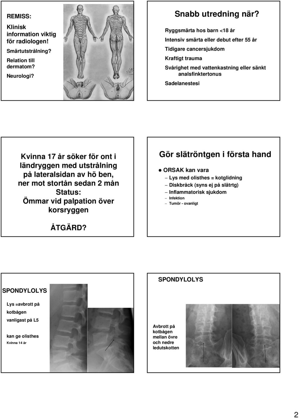 söker för ont i ländryggen med utstrålning på lateralsidan av hö ben, ner mot stortån sedan 2 mån Status: Ömmar vid palpation över korsryggen Gör slätröntgen i första hand ORSAK kan vara Lys