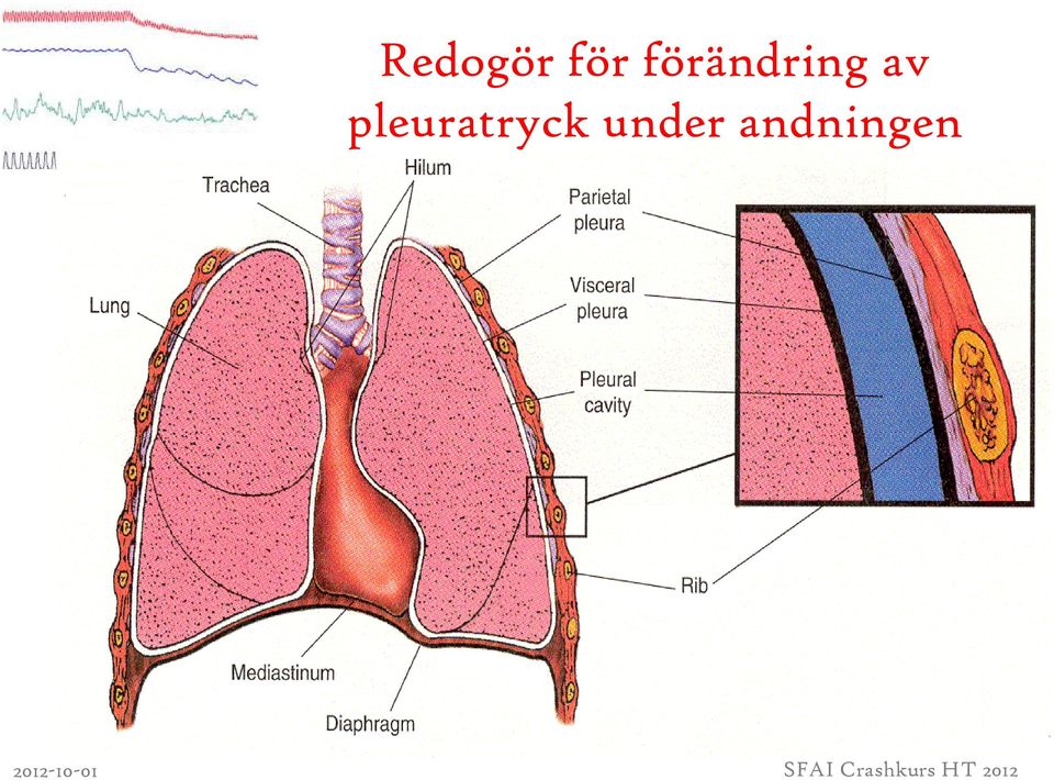 pleuratryck