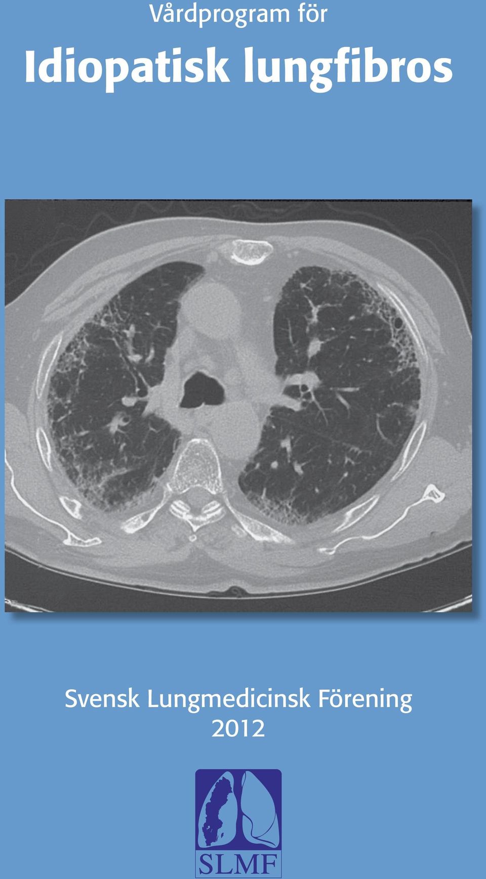 lungfibros Svensk