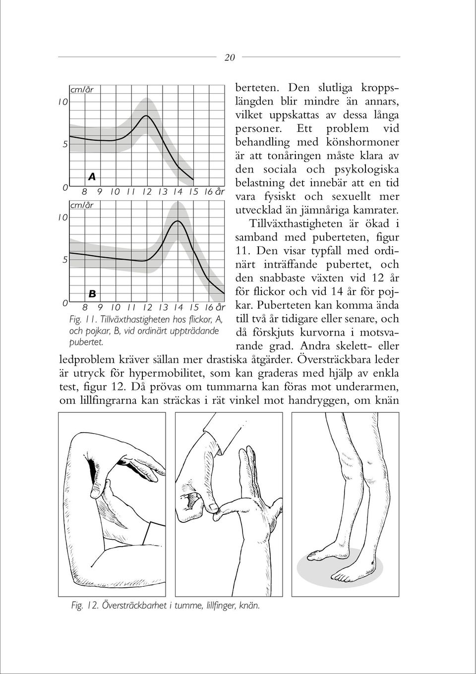kamrater. Tillväxthastigheten är ökad i samband med puberteten, figur 11. Den visar typfall med ordinärt inträffande pubertet, och den snabbaste växten vid 12 år för flickor och vid 14 år för pojkar.