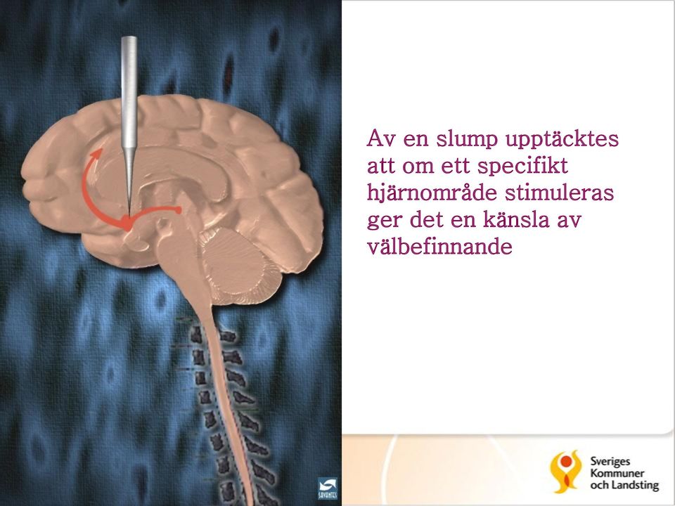 specifikt hjärnområde
