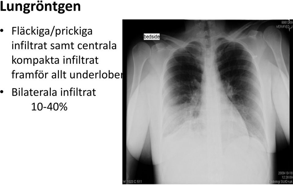 kompakta infiltrat framför