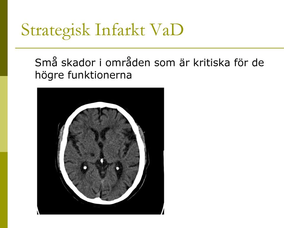 områden som är