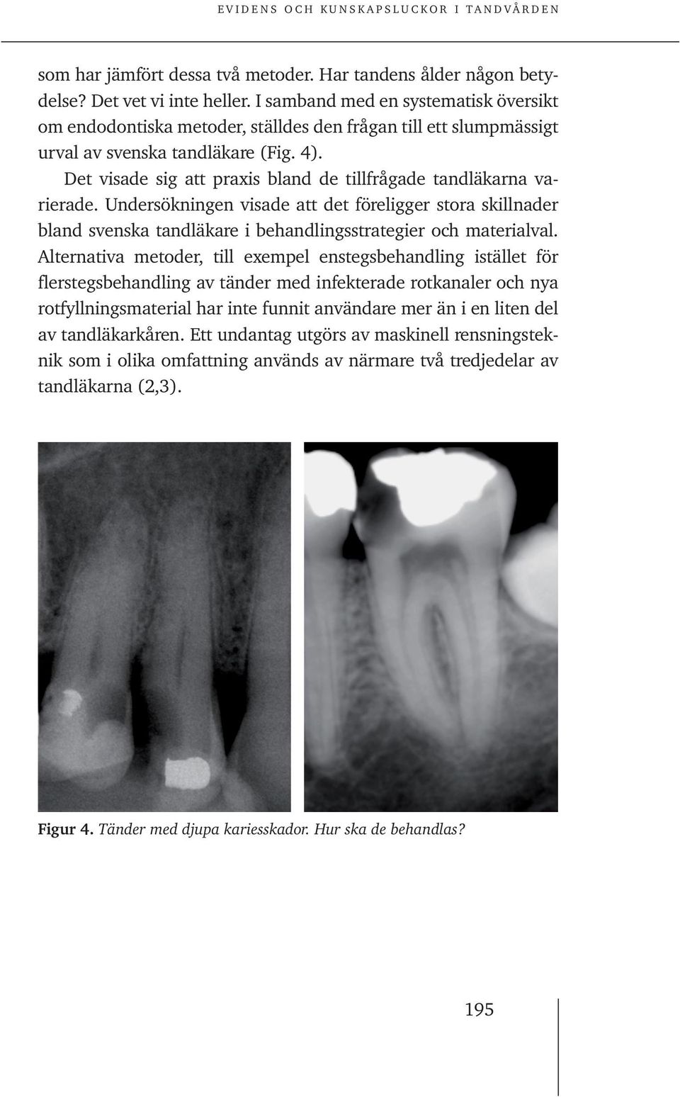Det visade sig att praxis bland de tillfrågade tandläkarna varierade. Undersökningen visade att det föreligger stora skillnader bland svenska tandläkare i behandlingsstrategier och materialval.