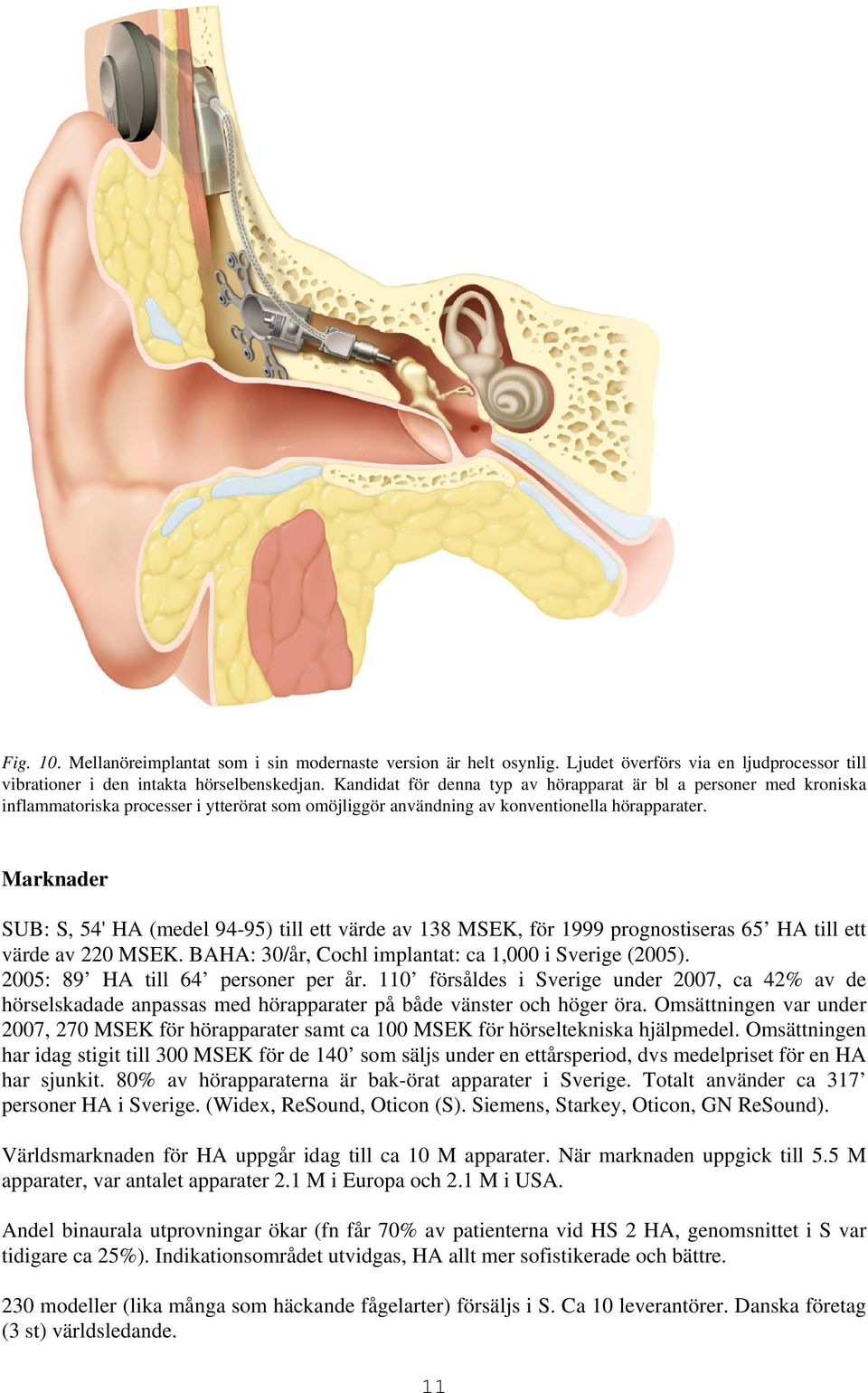 Föreläsning om hörapparater och hörseltekniska hjälpmedel för ...