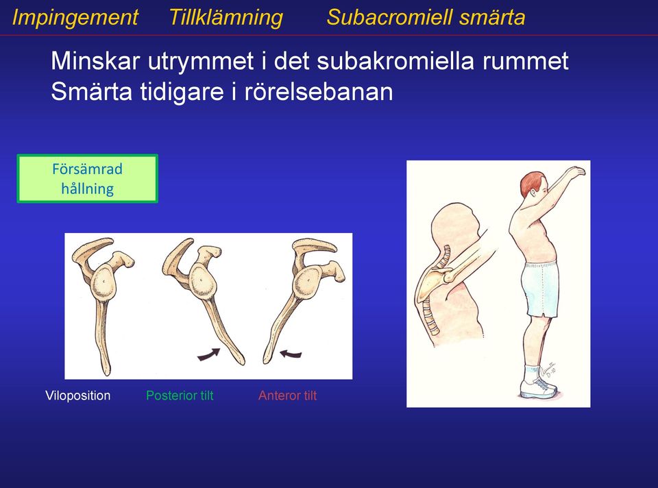 Smärta tidigare i rörelsebanan Försämrad