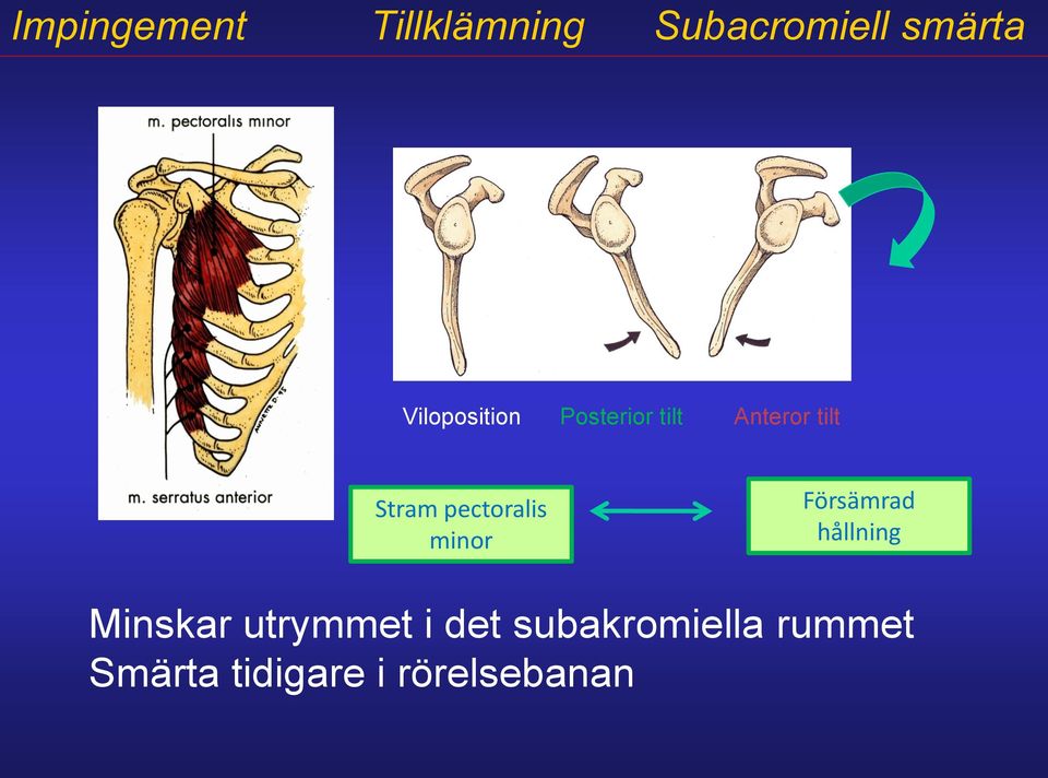 pectoralis minor Försämrad hållning Minskar