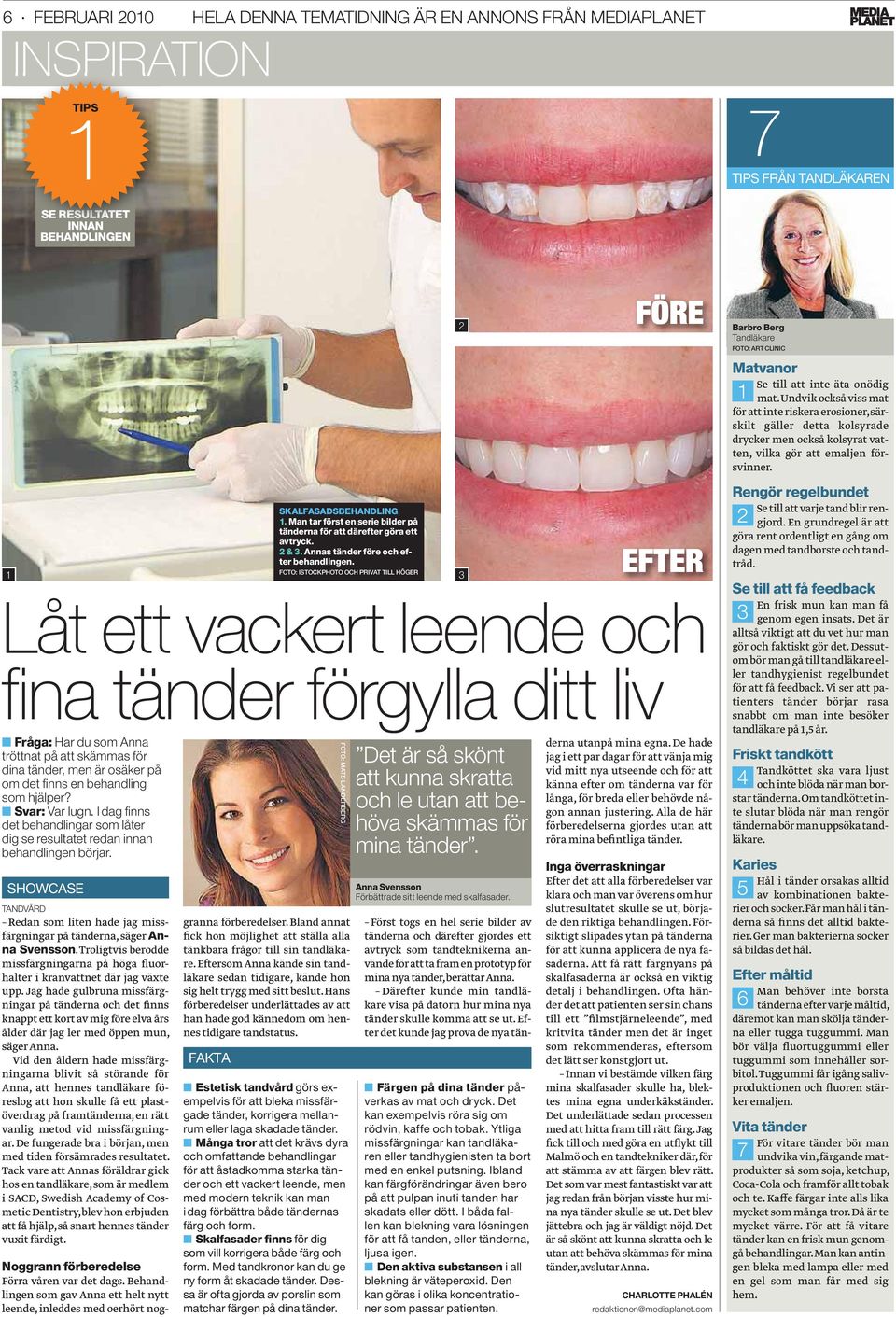I dag fi nns det behandlingar som låter dig se resultatet redan innan behandlingen börjar. SHOWCASE TANDVÅRD Redan som liten hade jag missfärgningar på tänderna, säger Anna Svensson.
