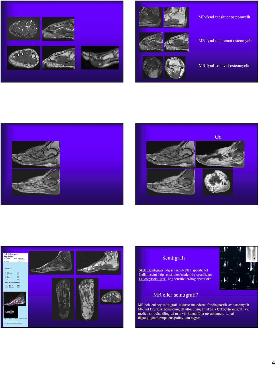 MR eller scintigrafi? MR och leukocytscintigrafi säkraste metoderna för diagnostik av osteomyelit.