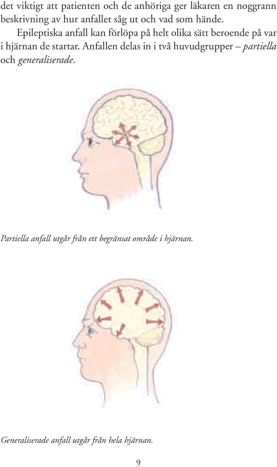 Epileptiska anfall kan förlöpa på helt olika sätt beroende på var i hjärnan de startar.